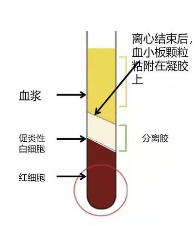 PRP在膝关节常见疾病中的临床应用－凯斯骨科！