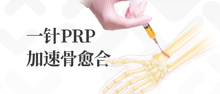 【典型病历】一针PRP加速骨折/骨不连/术后愈合康复